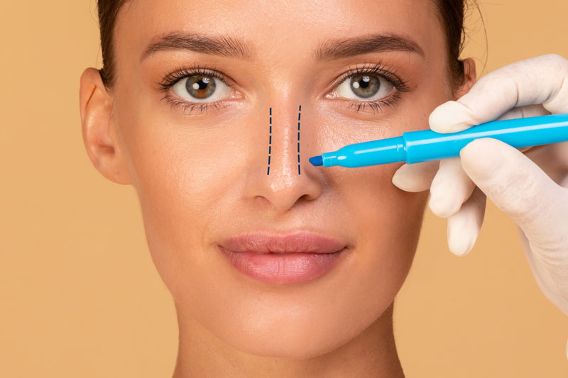 Rhinoplasty – Where Improved Breathing Meets Natural Beauty