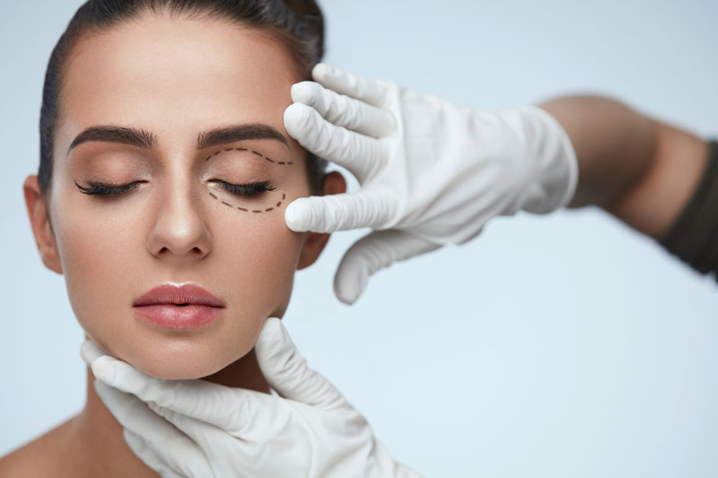 How Long Do the Results of Eyelid Surgery (Blepharoplasty) Last?